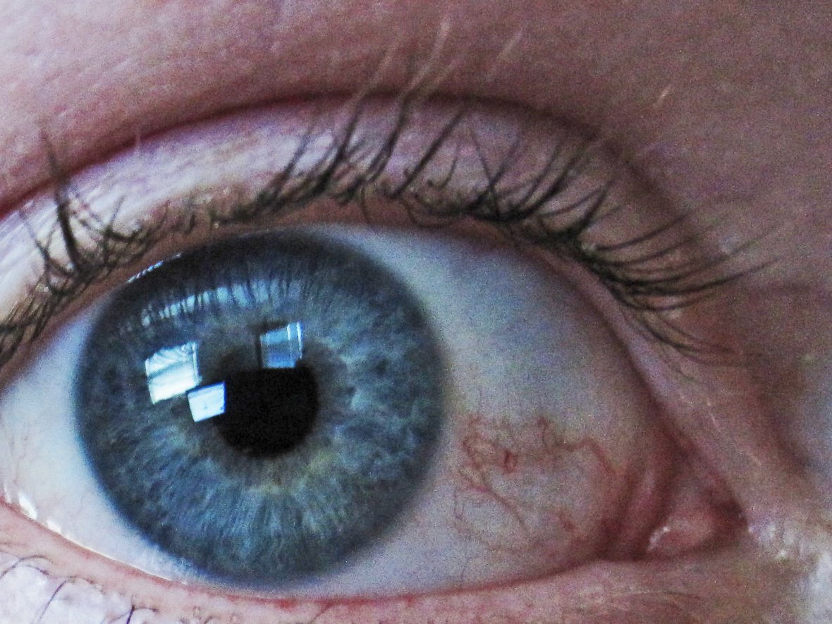 It can be used to treat Glaucoma. 