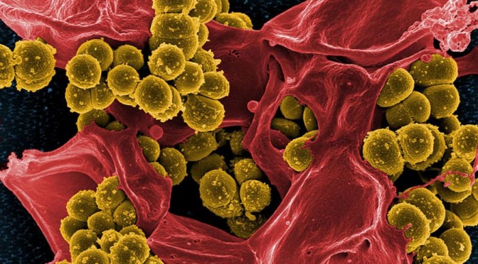 Superbugs Render Drugs Obsolete; How to Prepare for the Next Pandemic
