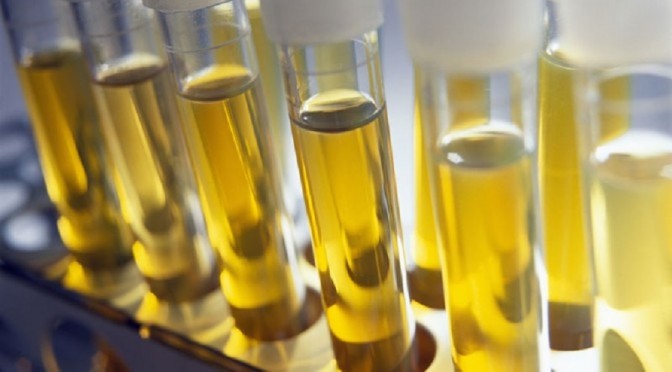 Carcinogenic Glyphosate Discovered In 93% of Urine Samples | UCSF Study