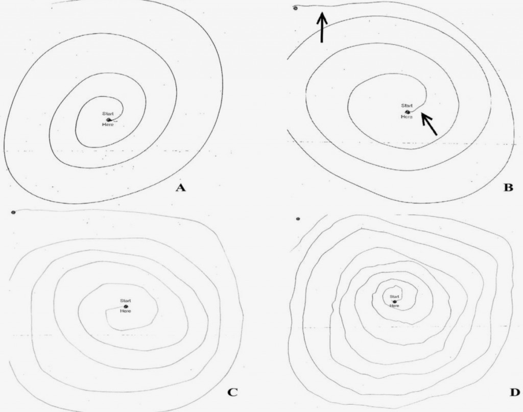 From a presentation by Virginia Rauh of the Columbia University Center for Children’s Environmental Health, based on a study of 317 children in New York City. Children were asked to perform a free-hand motor test called an Archimedes Spiral. Children in the group with high chlorpyrifos exposure had higher rates of clinically meaningful tremor.  Photo: E. Louis, W. Garcia, V. Rauh, Pediatric Neurology, February 2015
